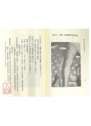 董氏五行刺络针法