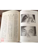 针灸秘验(上下)、图解针灸入门、针灸十绝招、眼针疗法（国医国宝系列套书共5册）